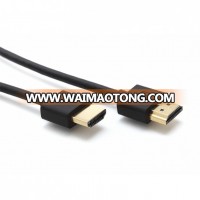 Original Xiaomi 1.5M Standard Cable Male to Male 1080p High Definition Data Cord for HDTV TV Box PS3 xBox LCD DVD